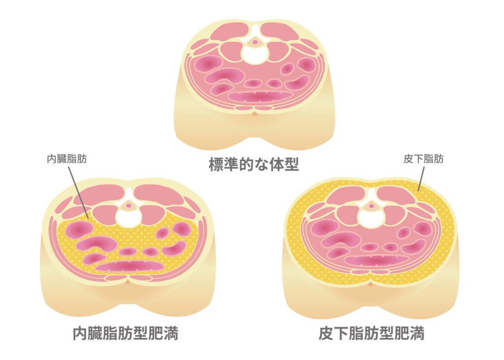 体重は減ったのにお腹が凹まない理由｜内臓脂肪の落とし方と注意点